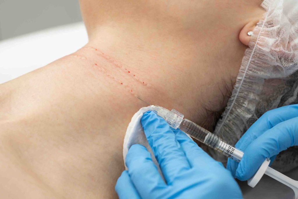 Common Turkle Neck Surgery and Procedures
