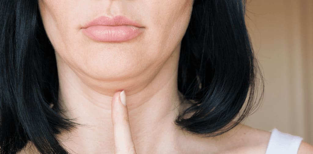 What causes a turkey neck?